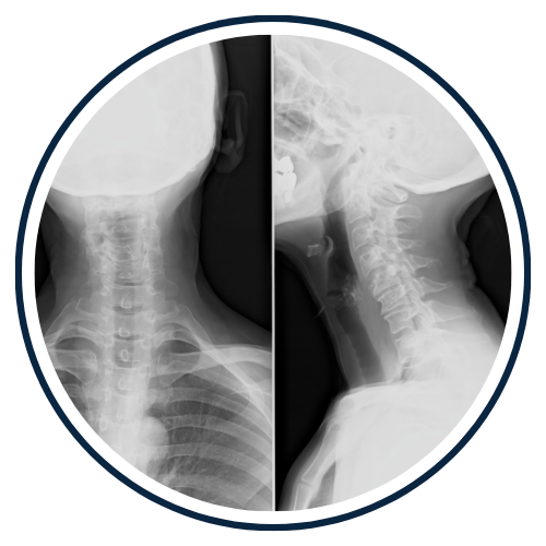 Gonstead X-rays north liberty
